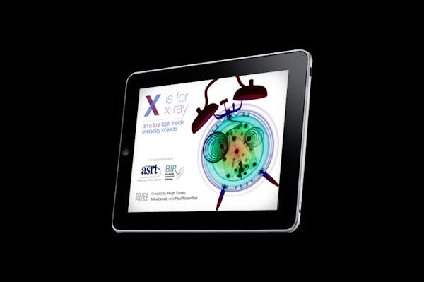 Local app for kids: X is for X-Ray