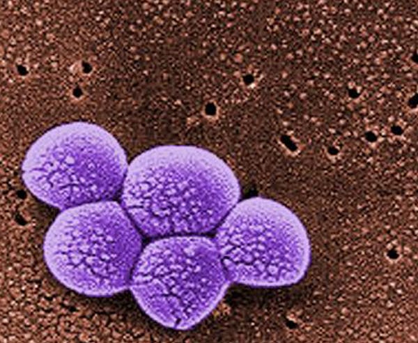 COURTESY JANICE CARR/CDC. Magnified 20,000X, this colorized scanning electron micrograph (SEM) depicts a grouping of methicillin resistant Staphylococ