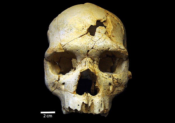 A skull discovered in a mass grave in Spain shows evidence of two blows located adjacent to each other just left of center on the forehead, researcher