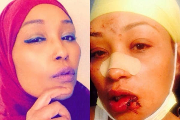 CAIR provided these photos of the victim, including one of her injuries.