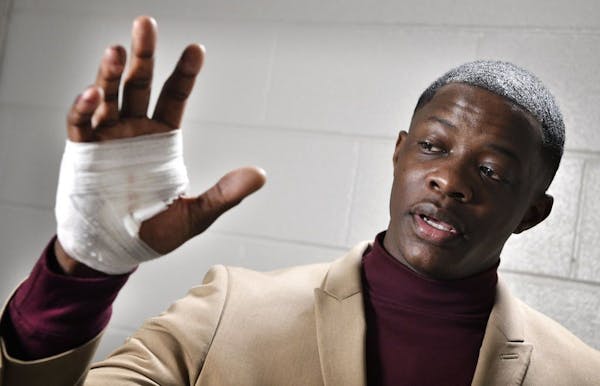 James Shaw Jr., shows his hand that was injured when he disarmed a shooter inside a Waffle House on Sunday, April 22, 2018, in Nashville, Tenn.