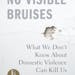 No Visible Bruises by Rachel Louise Snyder