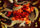 This electron microscope image made available by the U.S. National Institutes of Health shows the Novel Coronavirus SARS-CoV-2, in orange, emerging fr