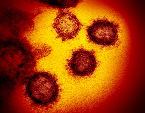 An electron microscope image made available by the U.S. National Institutes of Health in February 2020 shows the novel coronavirus SARS-CoV-2. The Uni