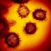 An electron microscope image made available by the U.S. National Institutes of Health in February 2020 shows the novel coronavirus SARS-CoV-2. The Uni