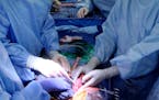 In this photo provided by the University of Alabama at Birmingham, surgeons check whether kidneys from a genetically modified pig are working in the b
