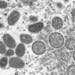 Mature, oval-shaped monkeypox virions, left, and spherical immature virions, right, are shown in a 2003 electron microscope image made available by th