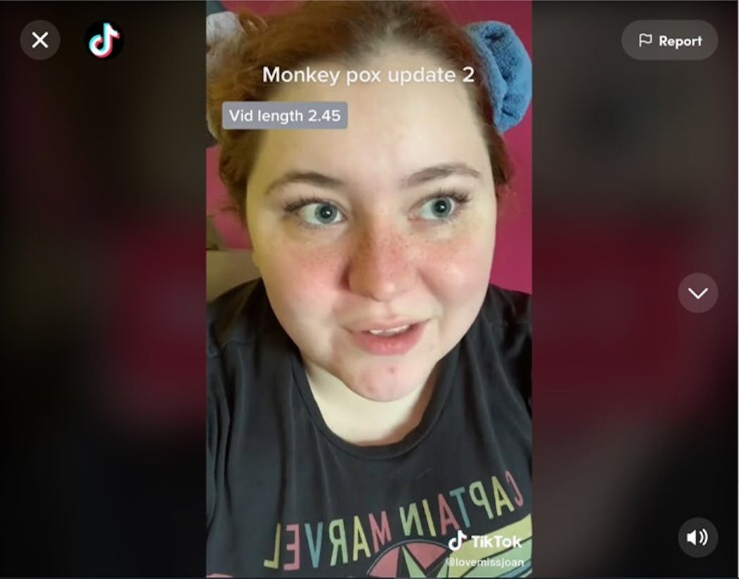 Joan Sullivan of Minneapolis has been making TikTok videos documenting the challenges of getting a test for monkeypox.