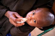 A child receiving life-saving RUTF (ready-to-use therapeutic food) in Somalia.