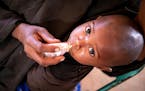 A child receiving life-saving RUTF (ready-to-use therapeutic food) in Somalia.