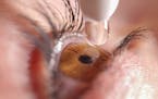 Artificial tears are a “subset” of eye drops, experts said.