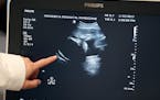 An ultrasound at the Mother Baby Center in Minneapolis from 2017. U.S. births were flat last year, as the nation saw fewer babies born than it did bef