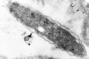 An electron microscope produced an up-close view of the bacteria that causes Legionnaires’ disease.