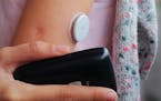San Diego’s Dexcom, a maker of continuous glucose monitors, laid out plans for a new wearable device coming in 2024 for people with Type 2 diabetes 